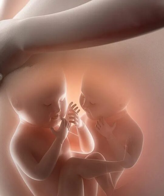 الحمل المتعدد